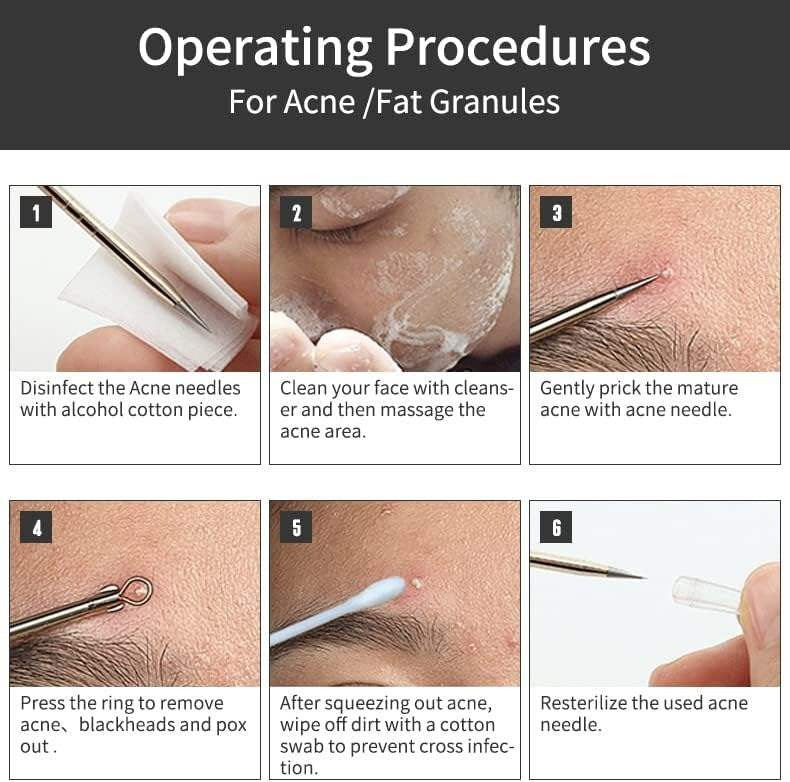 💓Last day discount💥Medical grade blackhead cell clip tool set