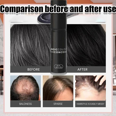 Scalp Concealer for Fuller, Natural-Looking Hair (BUY 1 GET 1 FREE )