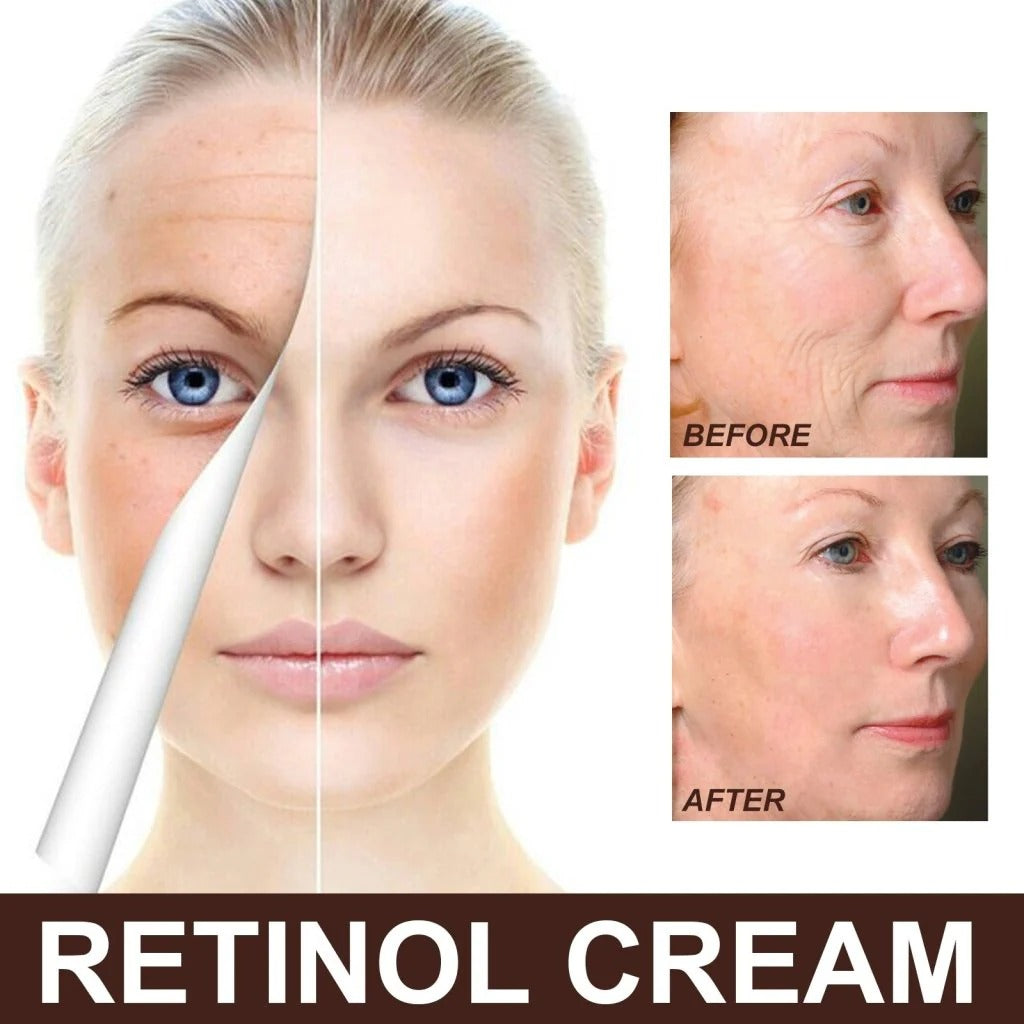 EELHOE Retinol Cream – Youthful, Radiant Skin Made Simple (Buy 1 Get 1 Free 🔥🔥)