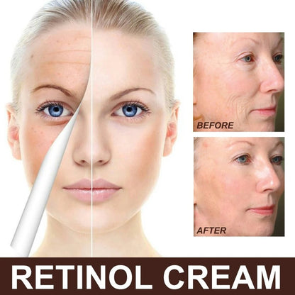 EELHOE Retinol Cream – Youthful, Radiant Skin Made Simple (Buy 1 Get 1 Free 🔥🔥)