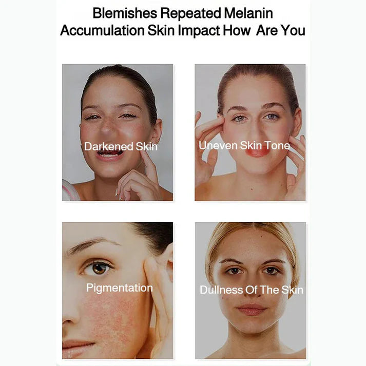 🎅Christmas promotion 49% OFF🎁Radiant Skin & Spot Correcting Spray | 🔥Buy 1 Get 1 Free 🔥