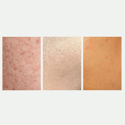 🎅Christmas promotion 49% OFF🎁Radiant Skin & Spot Correcting Spray | 🔥Buy 1 Get 1 Free 🔥