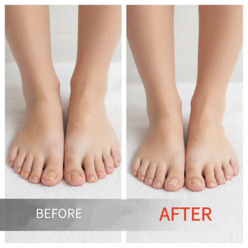 🔥Buy 1 Get 1 Free🔥 Nail repair essence for damaged nails