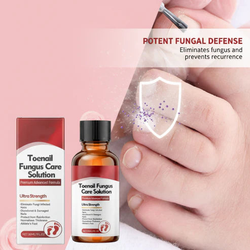 🔥Buy 1 Get 1 Free🔥 Nail repair essence for damaged nails