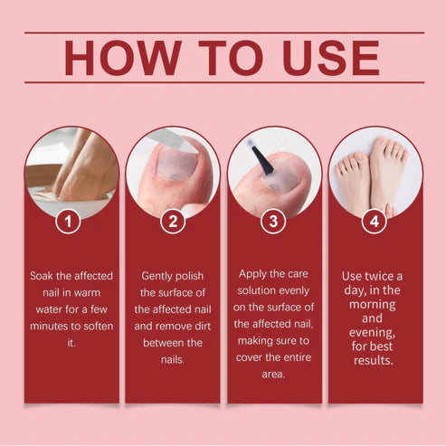 🔥Buy 1 Get 1 Free🔥 Nail repair essence for damaged nails