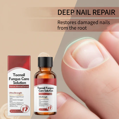 🔥Buy 1 Get 1 Free🔥 Nail repair essence for damaged nails